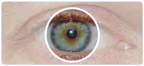 oeil